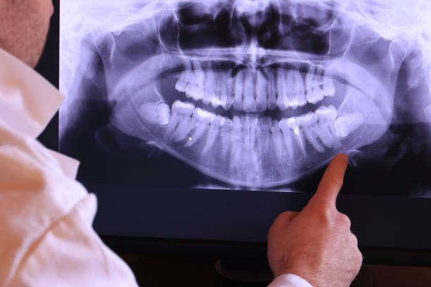 Best Emergency Dental Care for Abscessed Tooth in Fort Llins, CO