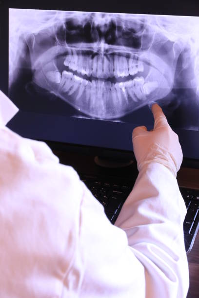 Best Emergency Dentist for Lost Fillings or Crowns in Fort Llins, CO